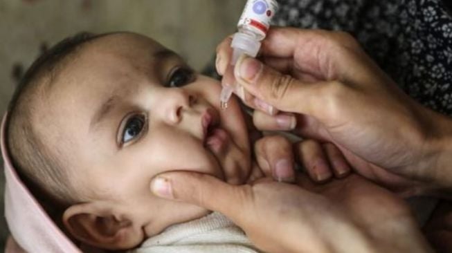 Anak Lumpuh dikarenakan Polio Padahal Imunisasi Lengkap, Kok Bisa? Pakar Ungkap Faktanya