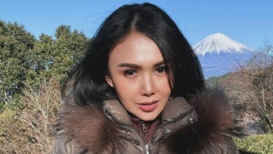 Yuni Shara Lakukan Perawatan Botox, Netizen: Ternyata Pengen Cantik Itu Mahal!